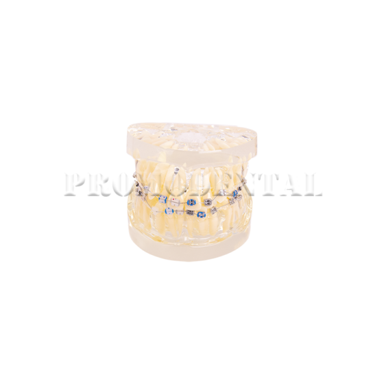 173-A0013-Teeth Model Ortho Metal & Ceramic 173-A0013